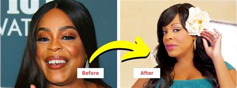 niecy nash plastic surgery|Niecy Nash: Navigating Plastic Surgery Speculations。